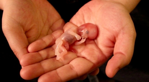 avortement_image-4.jpeg